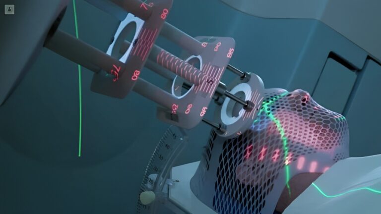 Lee más sobre el artículo Radiocirugía: Tratamiento preciso contra el cáncer